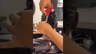 Перекрут кишечника X патево 🥵