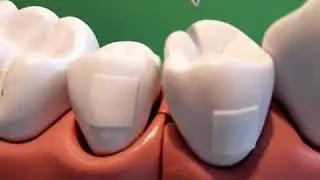 Zahnmerkmale UK Zaehne 🦷