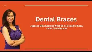 Jagdeep Sibia explains Types of Dental Braces