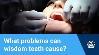 What problems can wisdom teeth cause?