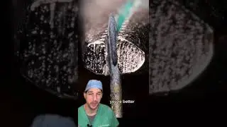 Sometimes they can't take the heat #Needle #Heat #Flame #Bacteria #Reuse #Dr #Nurse #Sterilize