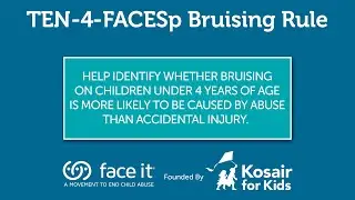 TEN-4-FACESp Bruising Rule (Animated)