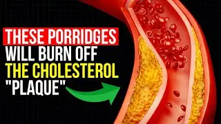 ATHEROSCLEROSIS is Afraid of these Porridges like fire! They cleanse the blood vessels in 7 days