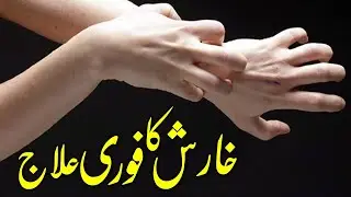 Kharish (Itching) Ka Fori Ilaj | Tibe Ahlebait (Part 26) | خارش | Maulana Syed Ali Naqi Kazmi