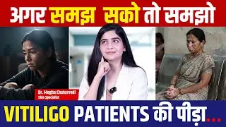 Vitiligo Patients Ki Zindagi: Daily Struggles Aur Ayurvedic Solutions | Dr. Megha