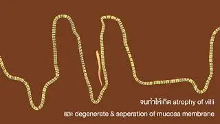 03 C philippinensis Pathogenesis and Symptoms