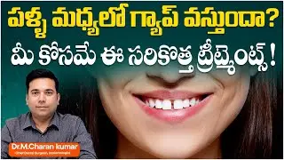 How To Fix Teeth Spacing or Teeth Gap? | Latest Dental Treatment Methods | Eledent Dental Hospitals