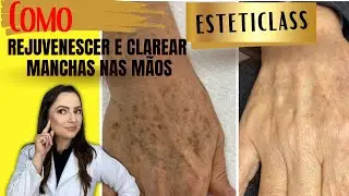 COMO REJUVENESCER E TRATAR AS MANCHAS NAS MÃOS E BRAÇOS?