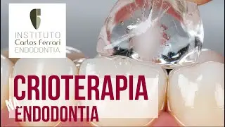 Cryotherapy in endodontics