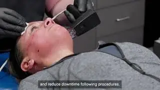 CMT Revision Post Procedure Cream