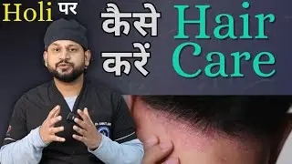 Holi Colours Side Effect || Can we use Holi ColoursAfter Hair Transplant || Hair Care on Holi