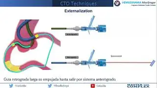 Externalization