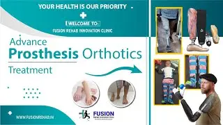 Orthoprosthesis // Artificial Leg // Leg Training // #fusion #orthotics #artificialleg.