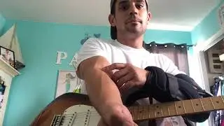 Distal bicep tear pre-physical therapy for guitar players. Best for muscular atrophy.