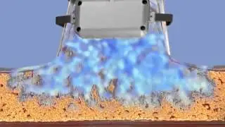 Cryolipolysis double chin removal with CoolSculpting London | Dr Kacem