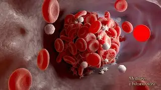 Giornata Mondiale Malattie Rare. nuovo farmaco per l'EPM, malattia ematologica ultra rara