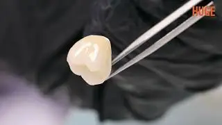 HUGE EternalArt Stain&Glaze Kit for Zirconia