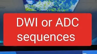 mri brain main Dwi or ADC sequences ko kese phachne #Dwi or ADC sequence