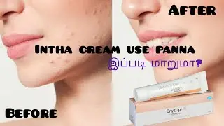 என்ன இந்த cream use panna ippadi maralama?😱Erytop.... #beauty #cream #beautiful 