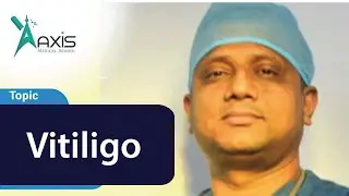Vitiligo