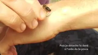 Apipuncture Douce - Comment piquer sans que l'abeille ne perde son dard?