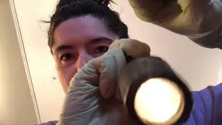 asmr mole removal rp (up close personal attention)