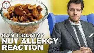 Nut Allergy Reaction &ndash; Can I Claim Compensation? ( 2019 ) UK