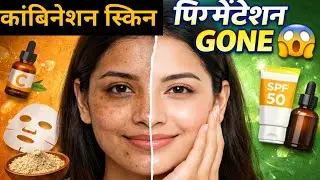 Combination Skin Care Routine ✨ Pigmentation, Uneven Skin & Dark Spots हटाएं
