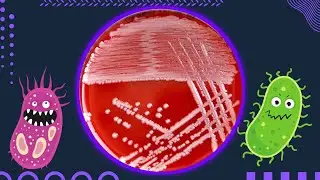 Blood Agar and Hemolysis: Alpha, Beta & Gamma with Bacterial Examples