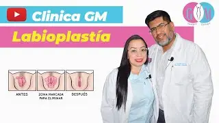 Labioplast&iacute;a
