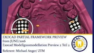 EXOCAD TUTORIAL 2016-Exocad Modellgussmodellation Preview 2 Teil 2- PARTIAL FRAMEWORK