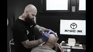 Scalp Micropigmentation with Magic Ink SMP #scalpmicropigmentation​​​ #scalptattoo ​​​ #hairtattoo