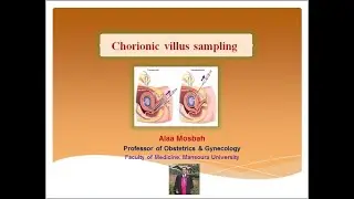 Chorionic villus sampling