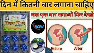 How To Apply Tiger king Cream || टाइगर किंग क्रीम का इस्तमाल कैसे करें || उपयोग, दुष्प्रभाव, मात्रा,