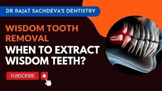 Painless Tooth Removal | Wisdom Extraction Treatment in Ashok Vihar, Delhi