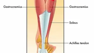 Calf muscle//Gastrocnemius//soleus muscle//Tendocalcanious