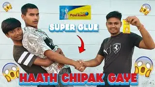 Kya Fevikwik Se Haath Alag Ho Payega 😱 |  Hand vs Super glue | Crazy Experiment 🔥