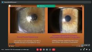 S&eacute;minaire 7 CEC de contactologie Les Lentilles rigides   Google Chrome 2022 05 20 14 11 51