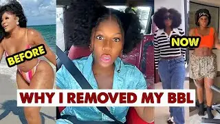 Destiny Etiko Reveals The Shocking Reason Why She Removed Her BBL yansh 