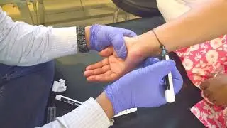 Wrist & Ankle Acupuncture Points location 