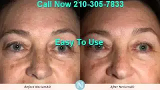 Why Does Nerium Work | 210-305-7833