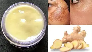 DIY Ginger Cream अदरक की क्रीम | Remove Pigmentation & Dark Spots-Anti-Aging & Skin Lightening Cream