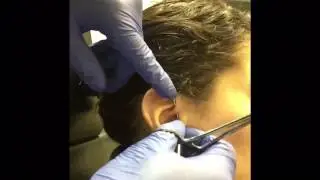 Daith piercing part 1 PAIN!!!!