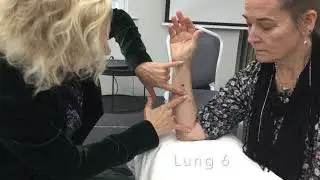 XI CLEFT POINTS ON THE ARM