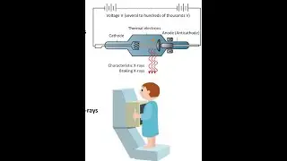 Lecture no 14 FRCR Physics (English Narration)