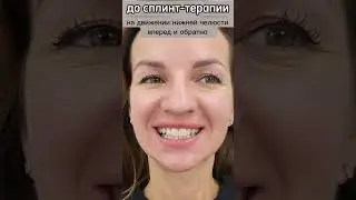 сплинт-терапия. +79269280055 Эдуард Сагателян. стоматолог Вашей здоровой улыбки