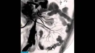 Diagnostic Imaging  Advanced CT Scans Transforming Care