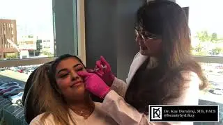 Undereye FIller with MUA Stella Kay