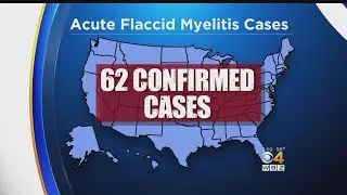 2 Cases Of Polio-Like Illness Acute Flaccid Myelitis Confirmed In Mass.