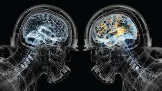 NFL Football Hits, Concussions, Injuries & a Lifetime of Pain